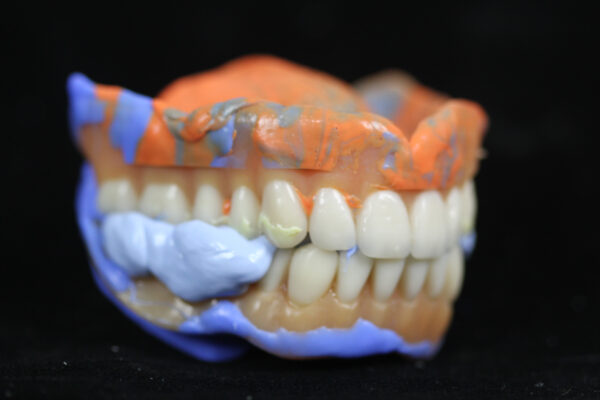 Digital Denture Course - March 28-29th, 2025 - Image 3